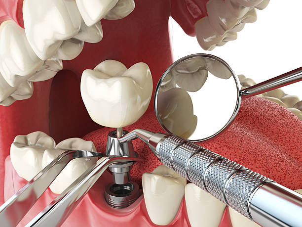 Best Broken or Chipped Tooth Repair in Stoughton, WI
