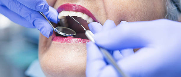 Best Knocked-Out Tooth (Avulsed Tooth) Treatment in Stoughton, WI
